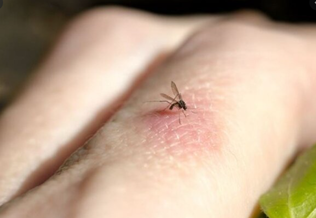 Stiderm Jel Ni in Kullan l r Fiyat Nedir Cilt Bak m m Cilt Bak m m Stiderm Jel Ni in Kullan l r Fiyat Nedir Cilt Bak m m Cilt Bak m m